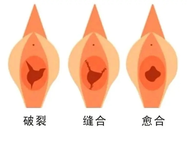 ͼƬ